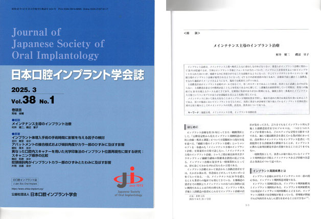 日本口腔インプラント学会誌　2025.3　Vol.38　No.１