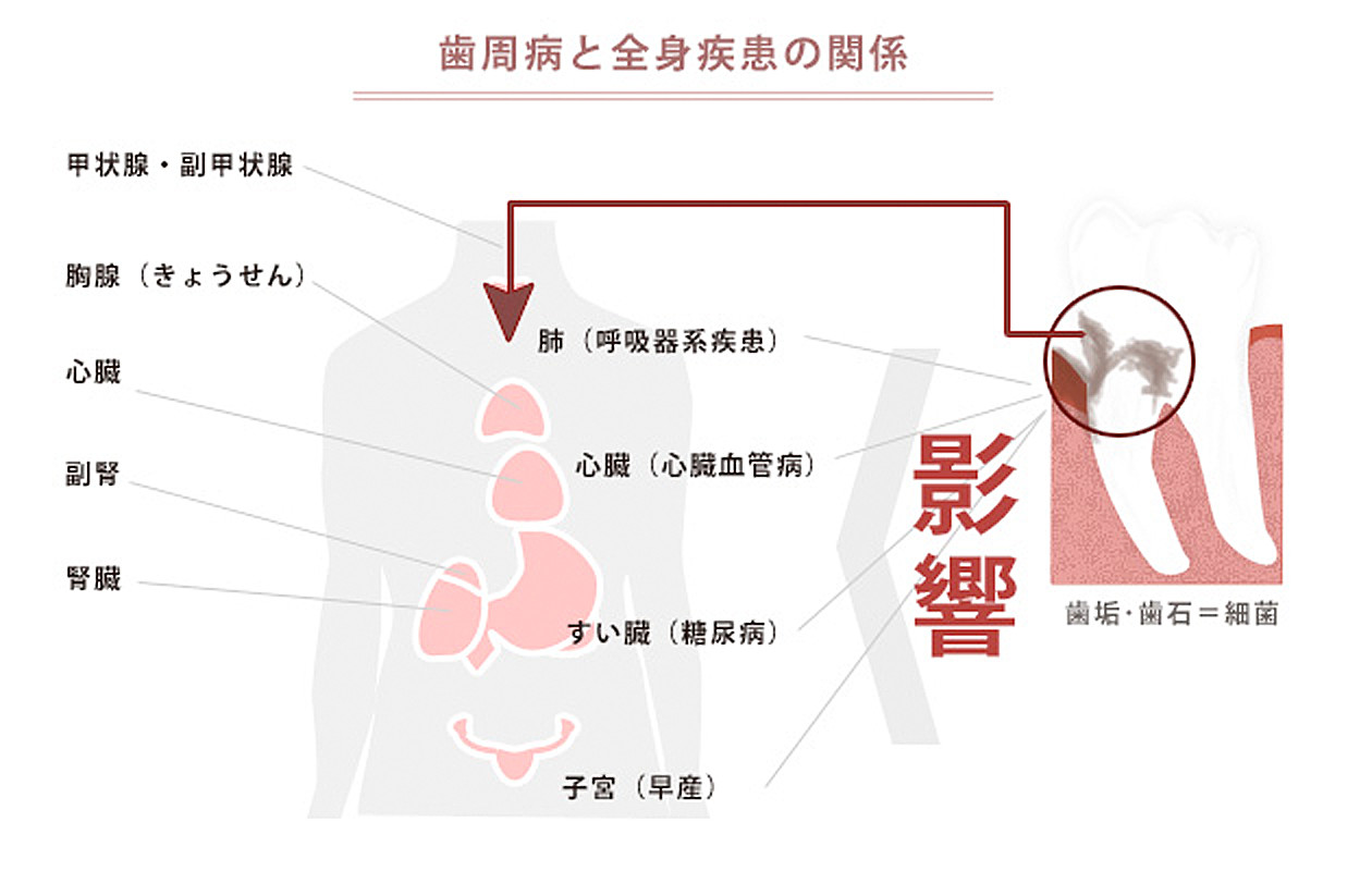 歯周病と全身疾患の関係